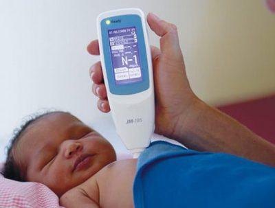 تشخیص زردی نوزاد با موبایل 