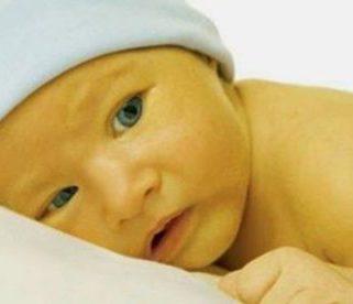تشخیص زردی نوزاد یا یرقان و عوارض آن در نوزادان
