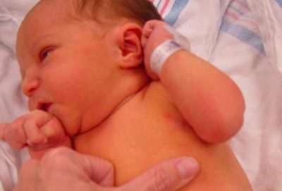 آیا مصرف لیموشیرین برای درمان زردی نوزاد مفید است؟