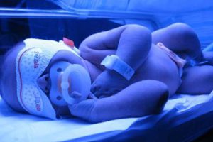 آیا دستگاه فتوتراپی پوست نوزاد را میسوزاند