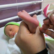 آزمایش زردی نوزاد و اهمیت تفسیر دقیق آن