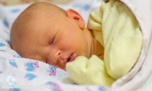 درمان زردی نوزاد در منزل